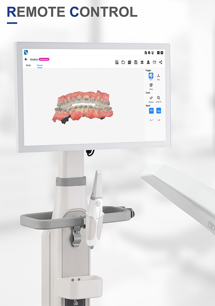 IOS33 Intraoral Scanner